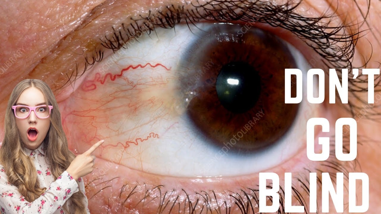 Restore Perfect Vision Naturally with One Eye Formula: Fact or Fiction?
